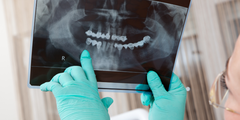 Photo of Een sprong voorwaarts voor de digitalisering van tandheelkundige zorg